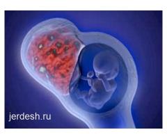 ❤️КРУГЛОСУТОЧНО 24/7  ❤️ 24/7 ВМС!❤️АБОРТ!❤️ПОДКОЖНЫЙ ИМПЛАНТ!❤️