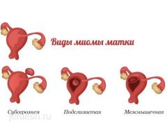 ❤️КРУГЛОСУТОЧНО 24/7  ❤️ 24/7 ВМС!❤️АБОРТ!❤️ПОДКОЖНЫЙ ИМПЛАНТ!❤️