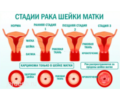 Гинекология Мамолог Онкогинеколог
