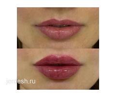 КОСМЕТОЛОГИЯ ПУДРОВЫЕ НАПЫЛЕНИЕ БРОВИ ГУБЫ ШУГАРИНГ УДАЛЕНИЕ ЭТО ЛУЧШИЙ ЛАЗЕР В МИРЕ