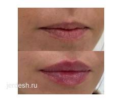 КОСМЕТОЛОГИЯ ПУДРОВЫЕ НАПЫЛЕНИЕ БРОВИ ГУБЫ ШУГАРИНГ УДАЛЕНИЕ ЭТО ЛУЧШИЙ ЛАЗЕР В МИРЕ