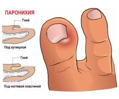 УРОЛОГ!✅ ПОДОЛОГ! ✅УДАЛЕНИЕ НОГТЯ✅ АЛЛЕРГОЛОГ✅ (ЛЕЧЕНИЕ АЛОПЕЦИИ),ТЕРАПЕВТ✅ ГАСТРОЭНТЕРОЛОГ ✅УРОЛОГ✅
