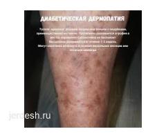 ✅КРУГЛОСУТОЧНО 24/7 ✅ПОДОЛОГ♂️♀️АЛЛЕРГИОЛОГ✅ТЕРАПЕВТ✅ ГАСТРОЭНТЕРОЛОГ ✅ЭНДОКРИНОЛОГ✅ОНКОЛОГ✅