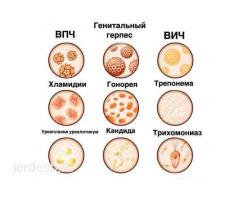 Круглосуточно ПРИЕМ ГИНЕКОЛОГА скидка 50%! Стаж более 10лет! i