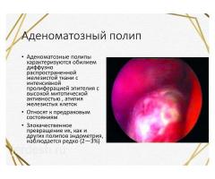 Круглосуточно ПРИЕМ ГИНЕКОЛОГА скидка 50%! Стаж более 10лет! i