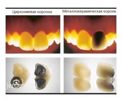 АКЦИЯ ЦИРКОН КОРОНКИ 10.000 ВРЕМЕННЫЕ КОРОНКИ БЕСПЛАТНО