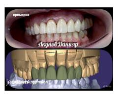 АКЦИЯ ЦИРКОН КОРОНКИ 10.000 ВРЕМЕННЫЕ КОРОНКИ БЕСПЛАТНО