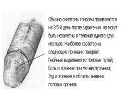 ✅КРУГЛОСУТОЧНО 24/7 ♂️✅ ГИНЕКОЛОГ♀️ ✅АНДРОЛОГ❤️ ✅НЕФРОЛОГ❤️✅СЕКСАПАТОЛОГ❤️✅