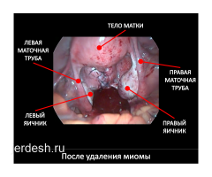 Маммолог!❤️Инфекциянын бардык турлорун дарылоо❤️! УЗИ!ПОДКОЖНЫЙ ИМПЛАНТ❤️