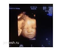ПРИЕМ ГИНЕКОЛОГА ❤️скидка 50%! Плазмолифтинг❤️Лечение эрозии ❤️АБОРТ❤️Сужение влагалища❤️