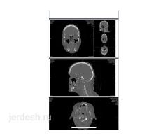 ВРАЧ-СТОМАТОЛОГ. ЧЕЛЮСТНО-ЛИЦЕВОЙ ХИРУРГ м. Добрынинская от метро 1-минута
