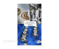 ВРАЧ-СТОМАТОЛОГ. ЧЕЛЮСТНО-ЛИЦЕВОЙ ХИРУРГ м. Добрынинская от метро 1-минута