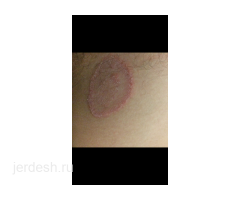 ✅9:00/22:00✅УЗИ ,СПРАВКА , ХИРУРГ, МАММОЛОГ,  ТЕРАПЕВТ, ДЕРМАТОЛОГ, УРОЛОГ