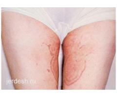 ✅9:00/22:00✅УЗИ ,СПРАВКА , ХИРУРГ, МАММОЛОГ,  ТЕРАПЕВТ, ДЕРМАТОЛОГ, УРОЛОГ