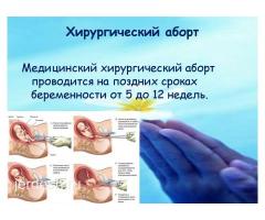 УЗИ❤АЯЛДАР ДАРЫГЕРИ!❤МАММОЛОГ ❤ ПОДКОЖНЫЙ ИМПЛАНТ! ❤АБОРТ❤