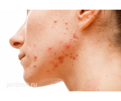 ✅9:00/22:00✅УРОЛОГ, Дерматолог, ФТИЗИАТР, ТЕРАПЕВТ, Гастроэнтеролог, Кардиолог Невролог