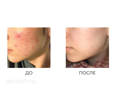 ✅9:00/22:00✅ПЕДИАТР✅АЛЛЕРГОЛОГ,ГАСТРОЭНТЕРОЛОГ,КАРДИОЛОГ, УРОЛОГ, ГИНЕКОЛОГ