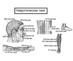 ИГЛОТЕРАПИЯ ✅ИЙНЕ МЕНЕН ДААРЫЛОО✅ТИЗЕ ООРУЛАРЫ✅БЛОКАДА✅ ГРЫЖА✅✅ ТИЗЕ, БУТ ООРУЛАРЫ!✅