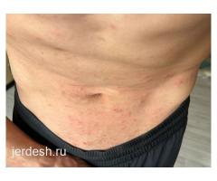 ✅9:00/22:00✅ ПЕДИАТР✅УРОЛОГ✅Невролог✅Гинеколог✅Дерматолог✅Терапевт✅Эндокринолог