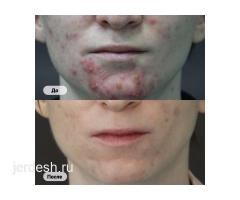 ✅9:00/22:00✅ ПЕДИАТР✅УРОЛОГ✅Невролог✅Гинеколог✅Дерматолог✅Терапевт✅Эндокринолог