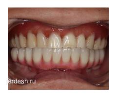 ВРАЧ СТОМАТОЛОГ-ИМПЛАНТОЛОГ. КАЧЕСТВО✅  ГАРАНТИЯ✅  БЕЗБОЛЕЗНЕННО ✅