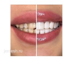 ВРАЧ СТОМАТОЛОГ-ИМПЛАНТОЛОГ. КАЧЕСТВО✅  ГАРАНТИЯ✅  БЕЗБОЛЕЗНЕННО ✅