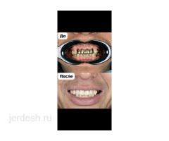 ВРАЧ СТОМАТОЛОГ-ИМПЛАНТОЛОГ. КАЧЕСТВО✅  ГАРАНТИЯ✅  БЕЗБОЛЕЗНЕННО ✅