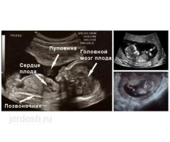 24/круглосуточно ✅Скрининг УЗИ 2500 РУБЛЬ ГИНЕКОЛОГ 10 ЖЫЛДЫК  СТАЖ МЕНЕН