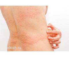 ✅9:00/22:00✅УРОЛОГ ГИНЕКОЛОГ ТЕРАПЕВТ ДЕРМАТОЛОГ КАРДИОЛОГ НЕВРОЛОГ