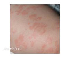 ✅9:00/22:00✅УРОЛОГ ГИНЕКОЛОГ ТЕРАПЕВТ ДЕРМАТОЛОГ КАРДИОЛОГ НЕВРОЛОГ