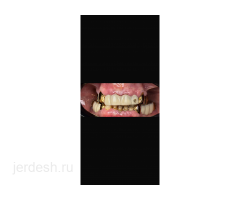 СТОМАТОЛОГ-ХИРУРГ. 1-2 минута от м Добрынинская